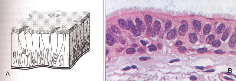 Γ. Ψευδοεπιθήλιο Παράδειγμα ψευδοπολύστιβου επιθηλίου: το κροσσωτό επιθήλιο των
