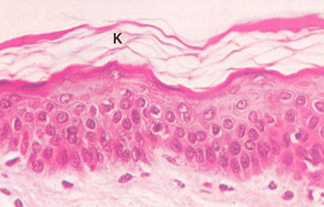 Το κερατινοποιημένο πολύστιβο πλακώδες επιθήλιο σχηματίζει την επιφάνεια του δέρματος (επιδερμίδα).