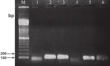 تشخيص سندرم داون با Real-Time PCR 0.24 0.20 0.16 0.12 0.08 0.04 0.00 C A -0.04 60 65 70 75 80 85 90 95 B 27.0 y = -3.32x + 28.27 26.5 R 26.0 2 = 0.9882 Series 1 25.5 Liner 25.0 24.5 24.0 23.5 23.0 22.