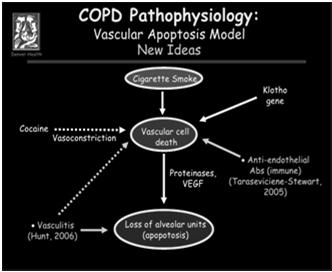 Η COPD είναι