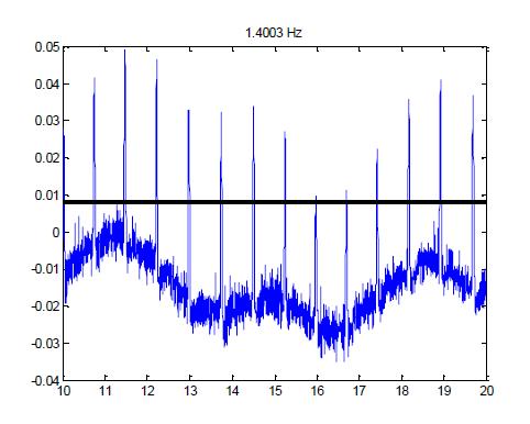 downsampled signal downsampled signal אז השאלה היא מהו קצב הדגימה האיטי ביותר כדי לזהות את קצב הלב? 0.05 2 Hz 0.05 3 Hz 0.04 0.04 0.03 0.03 0.02 0.02 0.01 0.01 0 0-0.01-0.01-0.02-0.02-0.03-0.