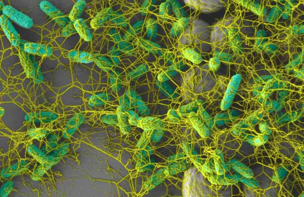 Escherichia coli K12