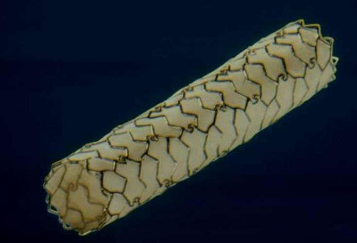 STENT graft