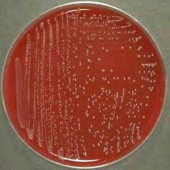 οργανισμών γνωστών και ως λακτικά οξέα βακτήρια (lactic acid bacteria, LAB) που παράγουν βακτηριοσίνες (Health Protection Agency, 2005). 23 Εικόνα 2.