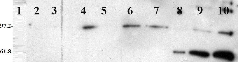 CRN in 20μl Εικόνα 28: Ανοσοανίχνευση πρωτεϊνών μετά από 1min έκθεση. 1. Protein marker 4μl 2. CLV1 in 6μl 3. CLV1 in 12μl 4.