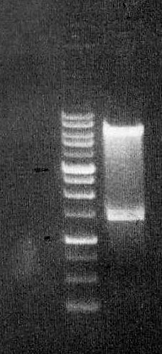 Σε πρώτο στάδιο πραγµατοποιήθηκε αποµόνωση του πλασµιδιακού DNA από τα βακτηριακά κύτταρα E. coli µε τη χρήση του kit NucleoSpin Plasmid Miniprep (βλέπε παράγραφο 4.2.8.