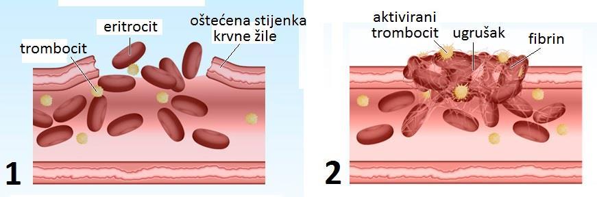 Zgrušavanje (koagulacija) krvi: stvaranje krvnog ugruška (koaguluma) -korisna koagulacija: sprečavanje gubitka krvi iz krvne ţile -štetna koagulacija: stvaranje ugruška u krvnoj ţili, čime se