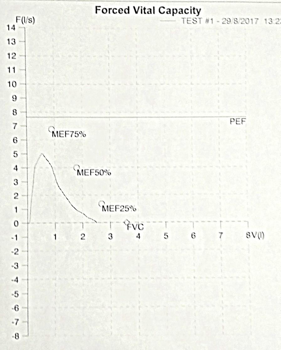 FVC :2,49 (69,4%) FEV1 :