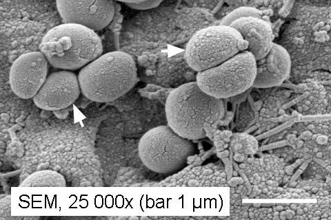 Scanning Electron Micrograph of a Staphylococcus epidermidis Biofilm on Foreign Material.