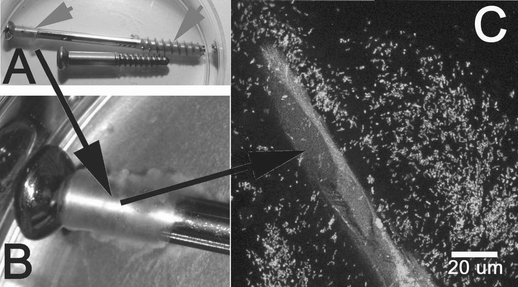 Molecular and Imaging Techniques for Bacterial Biofilms in Joint Arthroplasty Infections CLINICAL ORTHOPAEDICS AND RELATED RESEARCH 2005, 437,