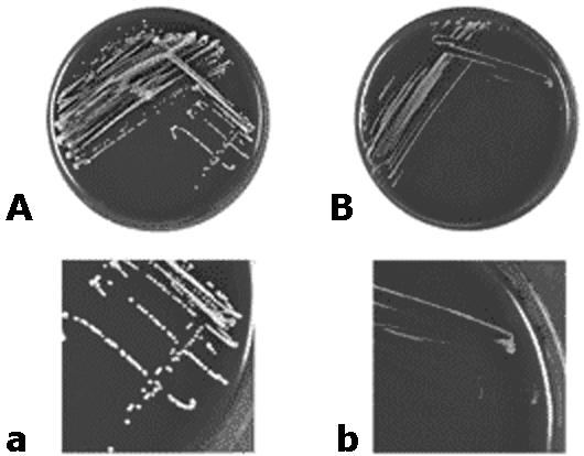 Σταφυλόκοκκοι με μικρές αποικίες (Small-colony variants) Daniëlle Neut, Acta Orthopaedica 2007; 78 (3): 299 308 DEFINITION OF PERIPROSTHETIC