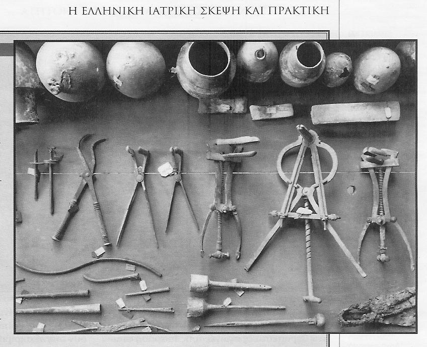 ΘΕΡΑΠΕΙΑ ΛΟΙΜΩΞΕΩΝ OΣΤΙΚΩΝ ΕΜΦΥΤΕΥΜΑΤΩΝ Εργαλεία στην οικία ενός ιατρού - Πομπηία 1ος αιώνας μχ ΑΝΤΙΜΕΤΩΠΙΣΗ ΛΟΙΜΩΞΕΩΝ ΠΡΟΘΕΣΕΩΝ Χειρουργικός καθαρισμός, διατήρηση πρόθεσης + αντιβιοτικά