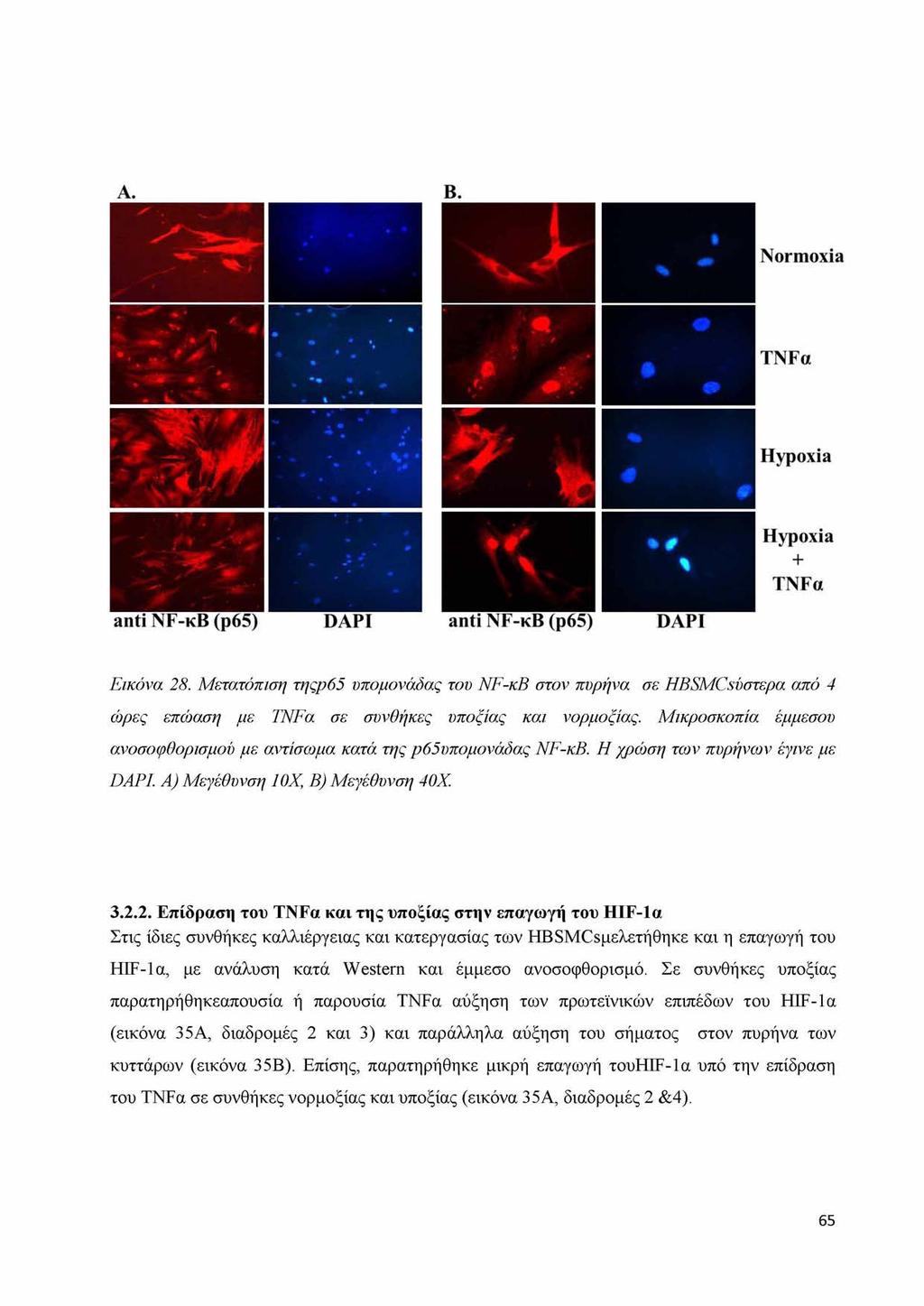A. B. Normoxia TNFa Hypoxia Hypoxia + TNFa anti NF-κΒ (p65) DAPI anti NF-κΒ (p65) DAPI Εικόνα 28.