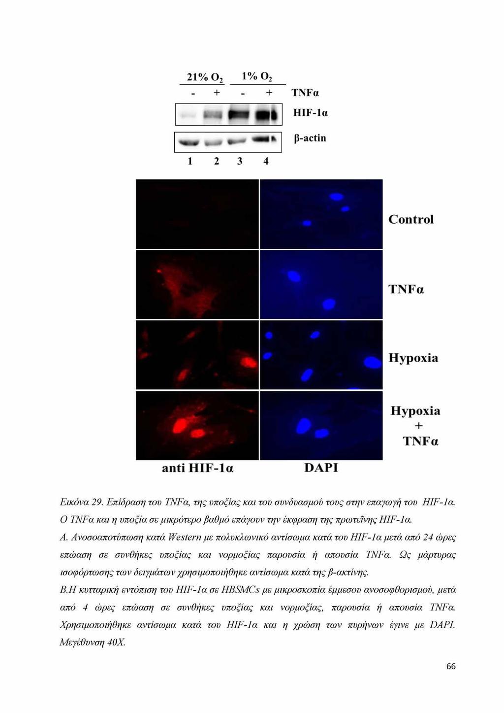 Control TNFa Hypoxia Hypoxia + TNFa anti HIF-Ια DAPI Εικόνα 29. Επίδραση του TNFa, της υποξίας και του συνδυασμού τους στην επαγωγή του HIF-1a.