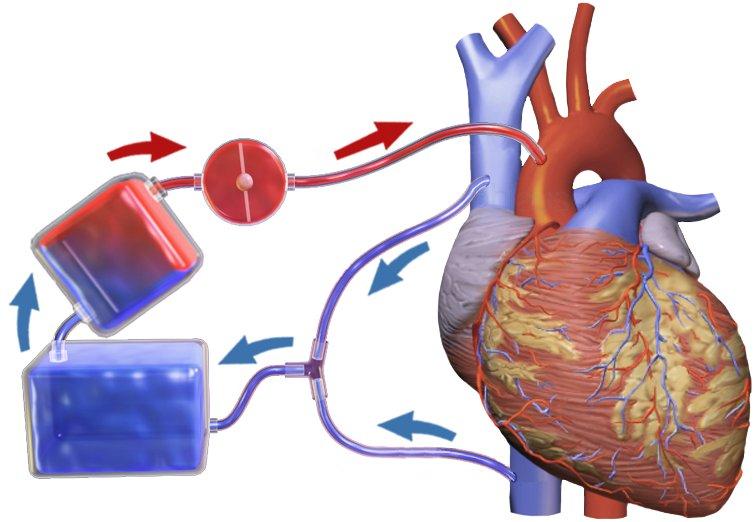 11. ЕКСТРАКОРПОРАЛНА ЦИРКУЛАЦИЈА ПРИ ОПЕРАЦИЈА КАЈ ПАЦИЕНТИ СО СРЦЕВА СЛАБОСТ Екстракорпоралната циркулација, односно кардио-пулмоналниот бајпас (КПБ) е техника која ја презема работата на срцето и