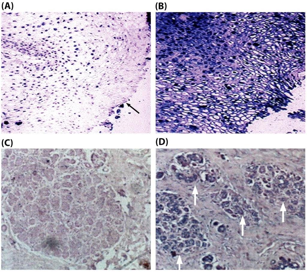 DNA methylation is an early event in carcinogenesis In situ hybridization Promoter of p16 INK4A Tumor supressor gene Methylation specific probe The Biology of Cancer ( Garland Science 2007) A) Low