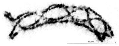 Obr. 11 Snímka spárovaných chromozómov počas meiózy (chiazma) (www.scilproj.org/ibhbio2knowledge.