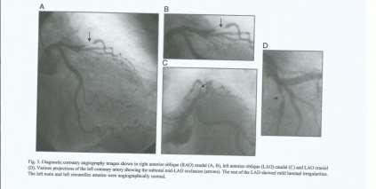 PERFUSION IMAGING, ANGIOGRAPHY Η σ π ι ν θ η ρ ο γ ρ α φ ι κ ή μ ε λ έ τ η ανέδειξε ε κ τ ε τ