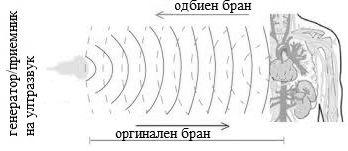 1. Биоакустика 21 Сл. 1.12: Принцип на работа на ултразвучно ехо. ни сигнали од граничните површини на ткивата со различен акустички импеданс.