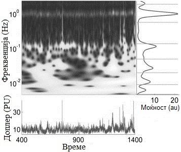 1. Биоакустика 24 Сл. 1.15: Пример за проток на крв измерен со доплеров ефект и негова временскоспектрална анализа.
