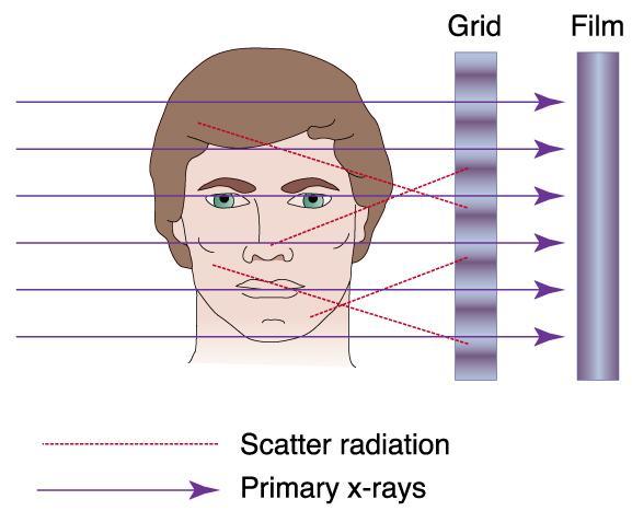 (From Haring J, Jansen L: Dental radiography: