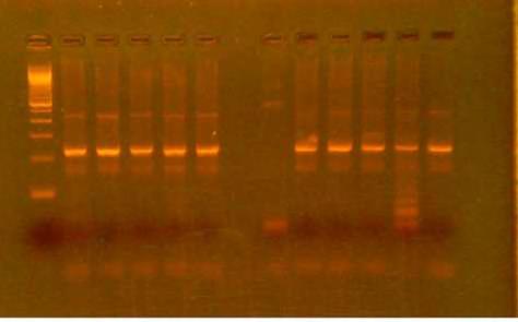 ΑΠΟΤΕΛΕΣΜΑΤΑ 6.1.Αποτελέσματα PCR με GAPDH εκκινητές Στην εικόνα 1 παρουσιάζονται τα αποτελέσματα της PCR για την ενίσχυση του γονιδίου GAPDH 12 ενδεικτικών κλινικών δειγμάτων.