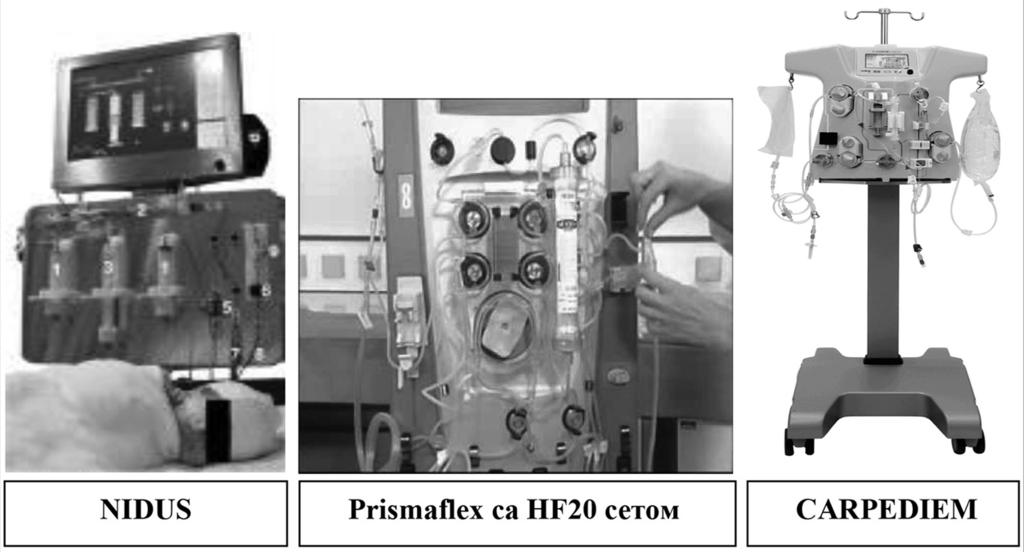 Весна Стојановић THE NEWCASTLE INFANT DIALYSIS AND ULTRAFILTRATION SYSTEM (NIDUS) Омогућава депурацију крви код деце телесне масе између 800 г и 8 кг.