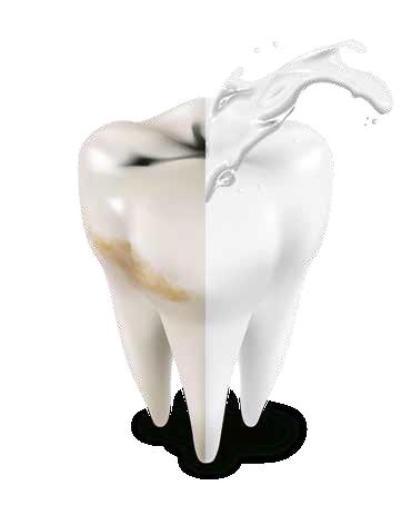 Αποκατάσταση μηχανικών - χημικών διαβρώσεων Ελάττωση της οδοντικής ευαισθησίας Μείωση της οδοντικής πλάκας 1 3 Στίλβωση των δοντιών 2 4 Τα σωματίδια του νανο