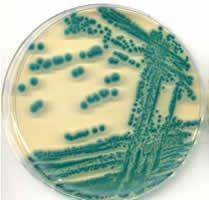 type R Bacillus CARACTERE DE CULTURA