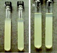 In functie de necesarul de oxigen: Bacterii Aerobe Anaerobe Aerob facultativ anaerobe Microaerofile Mediu lichid Bacterii anaerobe Medii pentru anaerobi: - Bulion cu acid thioglicolic (mediu lichid;