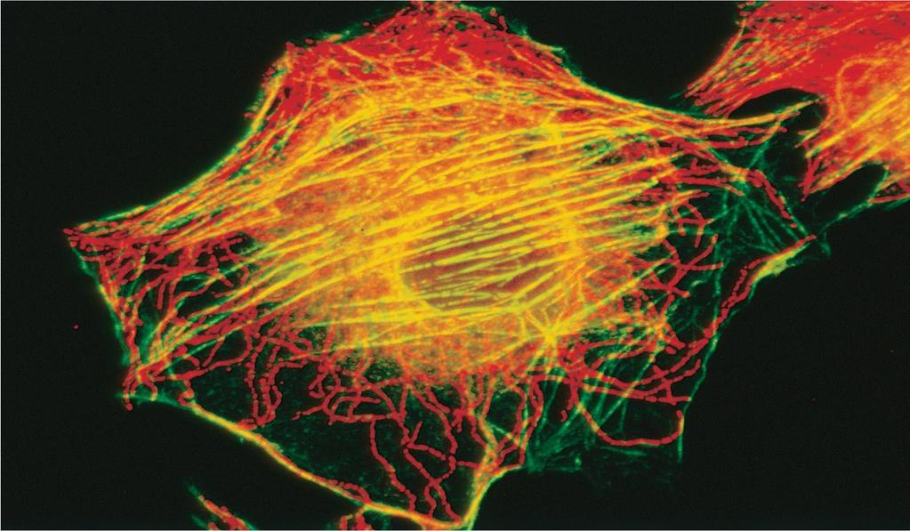 Συνεστιακή Μικροσκοπία (Confocal Microscopy) - ΙΙ Με σάρωση ΠΟΛΛΑΠΛΩΝ ΣΗΜΕΙΩΝ του δείγματος δημιουργείται δισδιάστατη εικόνα του επιπέδου εστίασης, πολύ πιο ευκρινέστερη από εκείνη της Συμβατικής
