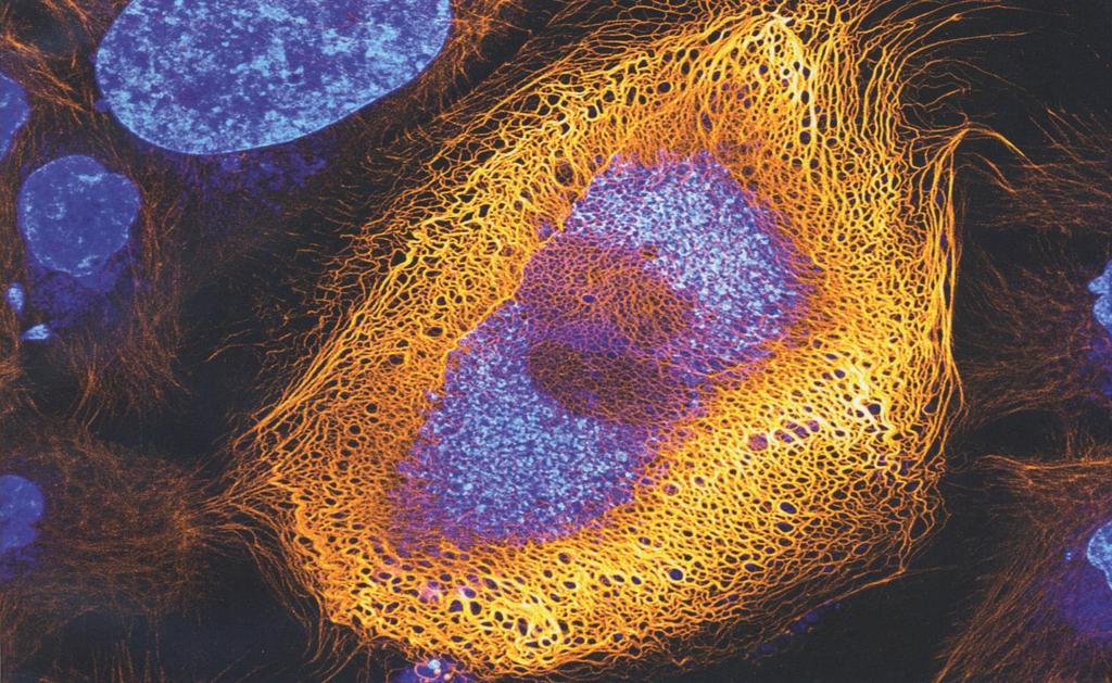 Συνεστιακή Μικροσκοπία (Confocal Microscopy) - ΙΙ Παράδειγμα Συνεστιακού Μικροσκοπίου ανθρώπινων