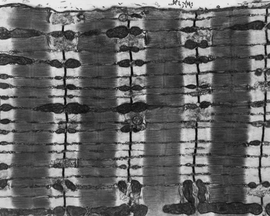 4 2 Athletes such as Chris Hoy, the 2008 Olympic cycling champion, increase their muscle mass and strength through a specialised training regime. (a) Fig. 2.1 is a photomicrograph of a sarcomere from a skeletal muscle fibre.