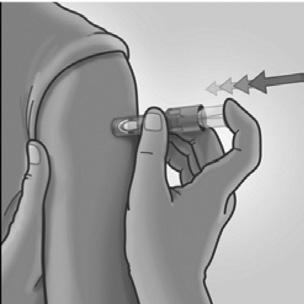 4. Inxectar usando o dedo índice Unha vez que a microagulla se introduciu, manter unha leve presión na superficie da pel e inxectar usando o dedo índice para presionar sobre o émbolo.