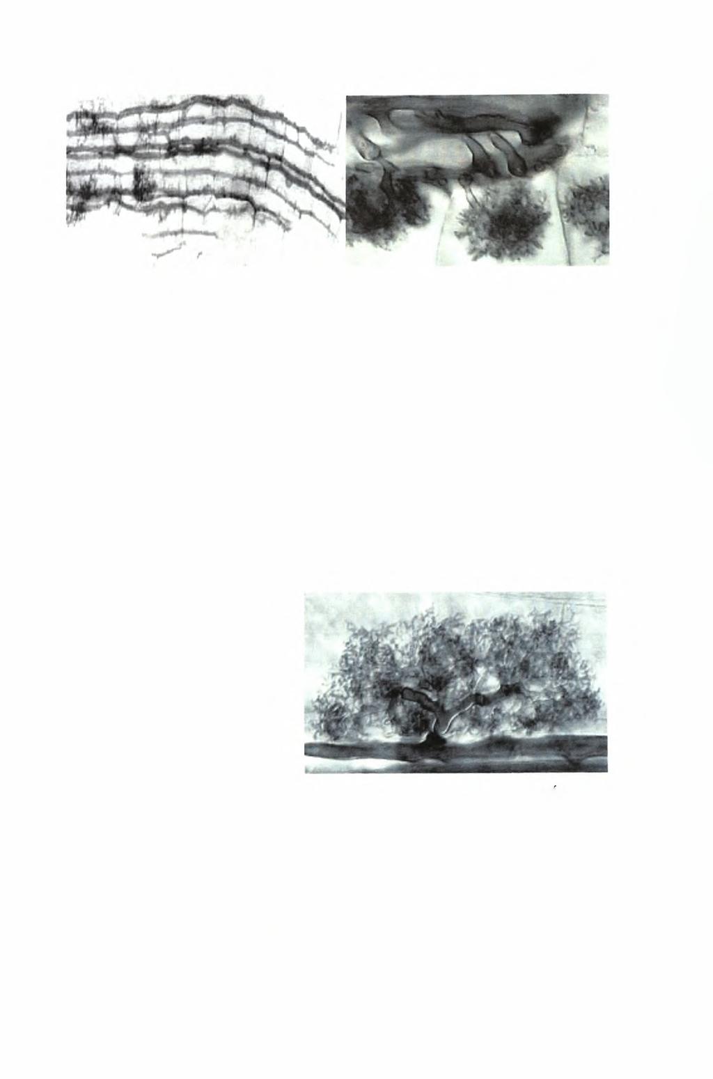 Εικόνα A.13: Μικροσκοπική παρατήρηση αποικιών τύπου Arum και Paris Πηγή: Παπαδάκη Ε. & Συντρίκου I. 2005 2.3.3.Ι.