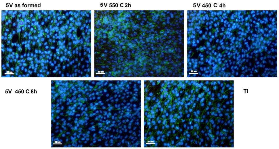 Expresia genica pentru osteocalcina si osteonectina in celulele liniei MG63 la 7 zile de la insamantarea pe probele de Ti si TiAlNb cu acoperiri de TiO 2 calcinate si necalcinate; a imaginea unui gel