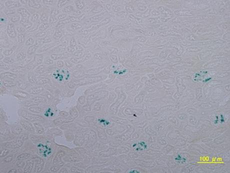 Heart Liver Spleen Lung Pancreas