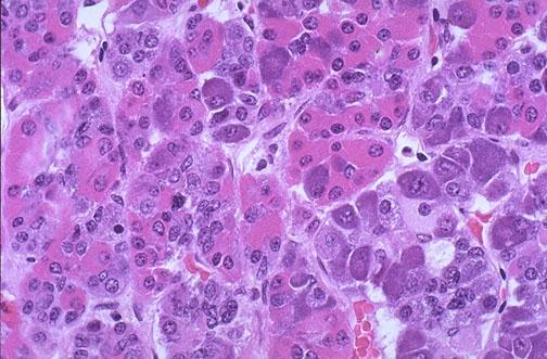 Ανατομία υπόφυσης μικροσκοπικά (2) Pars distalis Ροζ οξεόφιλα Αυξητική ορμόνη προλακτίνη Σκούρο μωβ βασεόφιλα Κορτικοτροπίνη