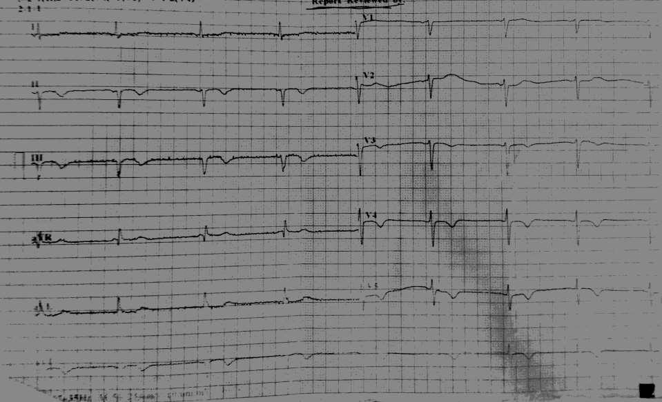 48 bpm-no