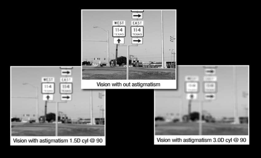 Vision without astigmatism