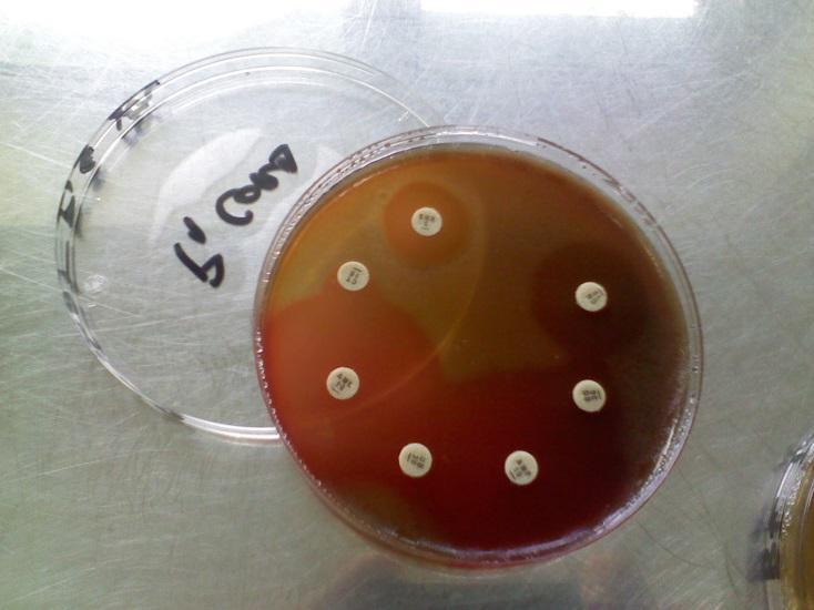 2 Antibiograma M.