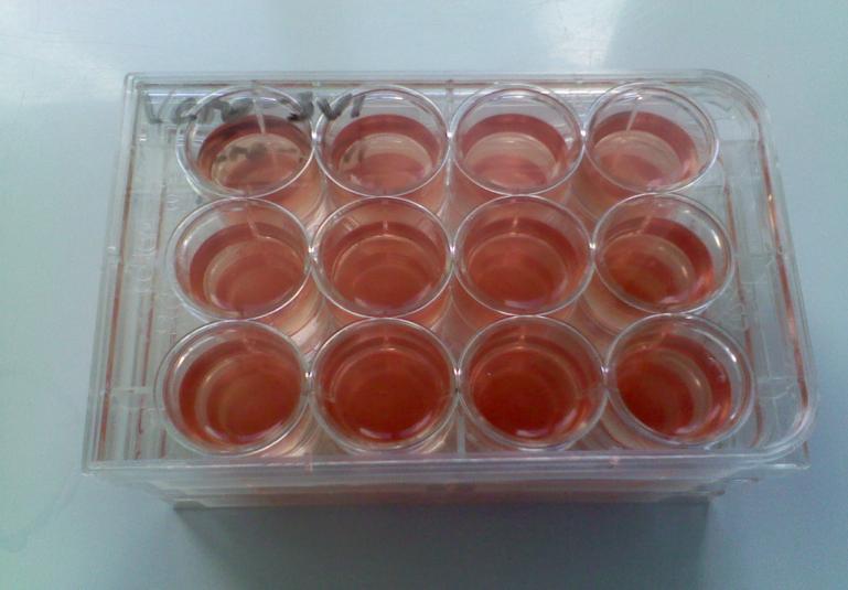 Fig.4 Probe de organe