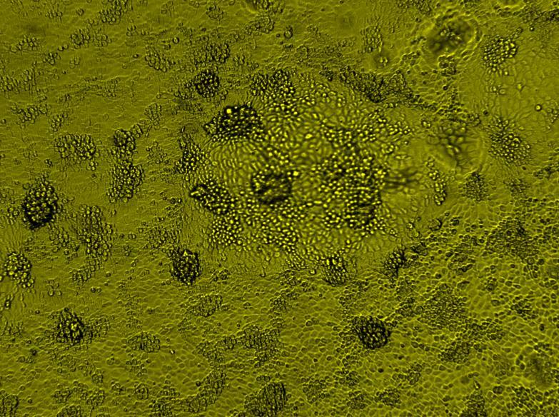 Plăcile au fost examinate zilnic în vederea urmăririi apariţiei unor modificări ale monostratului datorate inoculului, (prezenţa virusului), cu ajutorul unui microscop ranversat tip ZEISS, cu