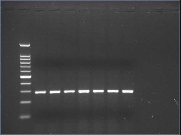 Analiza probelor recoltate Extracţia şi amplificarea au fost efectuate conform protocoalelor optimizate anterior.