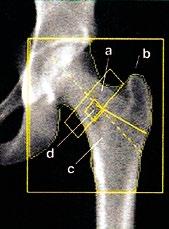 mugurkaula laterālās pozīcijas datus nevajadzētu izmantot diagnozes noteik šanai, bet tie var noderēt novērošanai; prasības DXA veikšanai bērniem: DXA aparātam jābūt piemērotam bērna vecumam un ar
