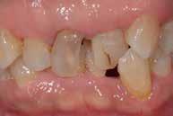 συνδρομητές Dentorama & Dental Journal 490 euro Διοργάνωση: Χορηγοί : Προ προσθετική χειρουργική φατνιακής ακρολοφίας Βιοψία βλάβης βλεννογόνου Διατήρηση φατνιακής ακρολοφίας