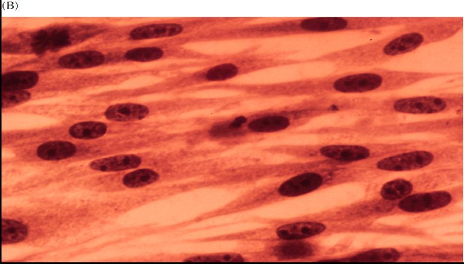 Φωτογραφία ινοβλαστών Κύτταρα με χαρακτηριστική μορφή επιμηκυσμένης ατράκτου Το αίμα είναι τύπος χαλαρού