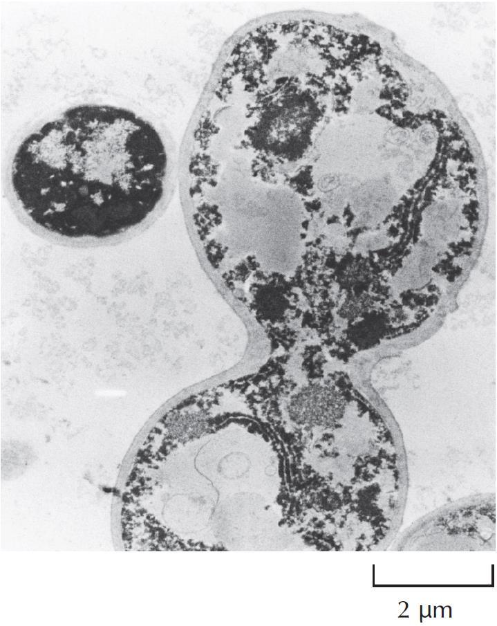 Μοντέλο Ευκαρυωτικών: o σακχαροζυμομύκητας Φωτογραφία: S. cerevisiae Ο Saccharomyces cerevisiae (μαγιά μπύρας) είναι μικρός πρότυπος ευκαρυώτης ζυμομύκητας.
