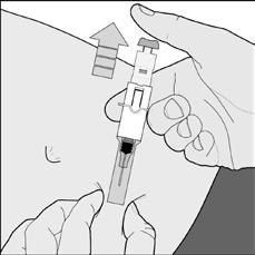 8. Ενέστε ΟΛΟ το περιεχόμενο της σύριγγας πιέζοντας το έμβολο όσο γίνεται προς τα κάτω (εικόνα Ε). Εικόνα Ε Σύριγγα με αυτόματο σύστημα 9.