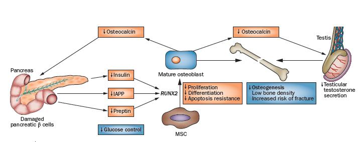 Σχέση οστικού μεταβολισμού και β-κυττάρου Pancreatic β-cell destruction in patients with T1DM prevents secretion of insulin, IAPP and preptin, thereby reducing their effects on the RUNX2 gene.